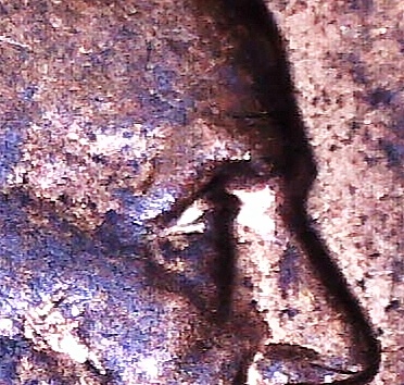 1989-P-LMC...normal-Eyelid-Or?